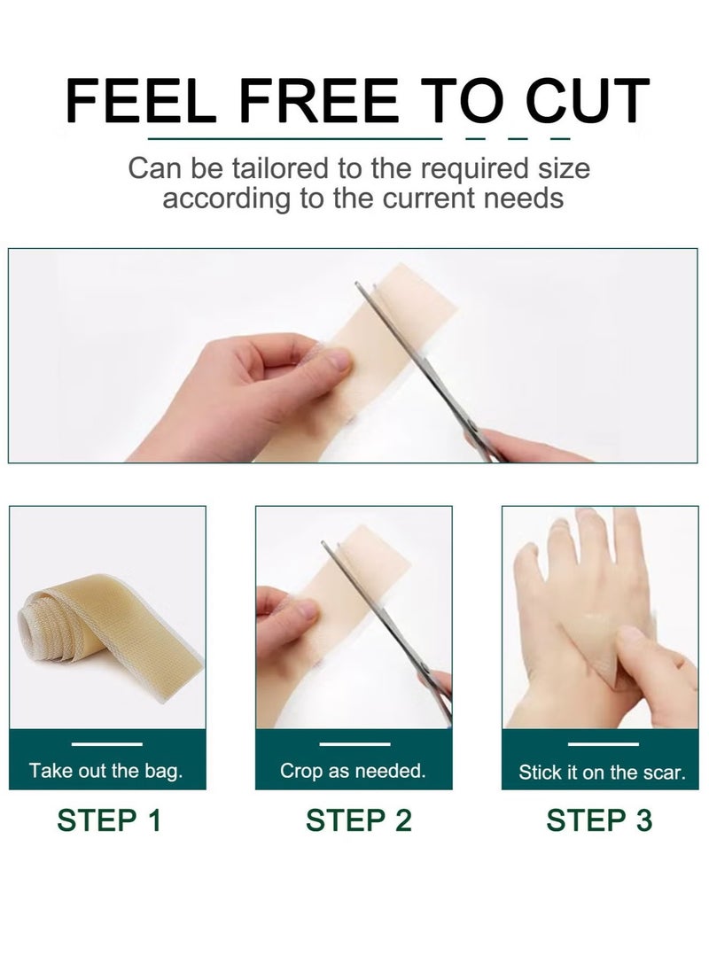 Elaimei - Silicone Scar Tape, Medical silicone scar remover sheet, stretch marks treatment waterproof silicone scar sheet 4cmx1.5m - Image 1