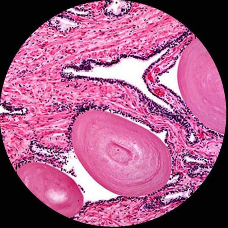 AmScope AmScope D120MS DualView Compound Monocular Microscope 40X1000X Magnification Brightfield 125 NA Abbe Condenser Mechanical Stage  - Image 5