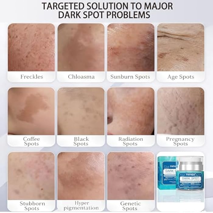 PAPABA Dark Spot Corrector Cream for Face & Body Women Men - Niacinamide + Vitamin C + Tranexamic Acid - Brightening Treatment for Age Spots, Sun Spots Gentle for Sensitive Skin - Image 5