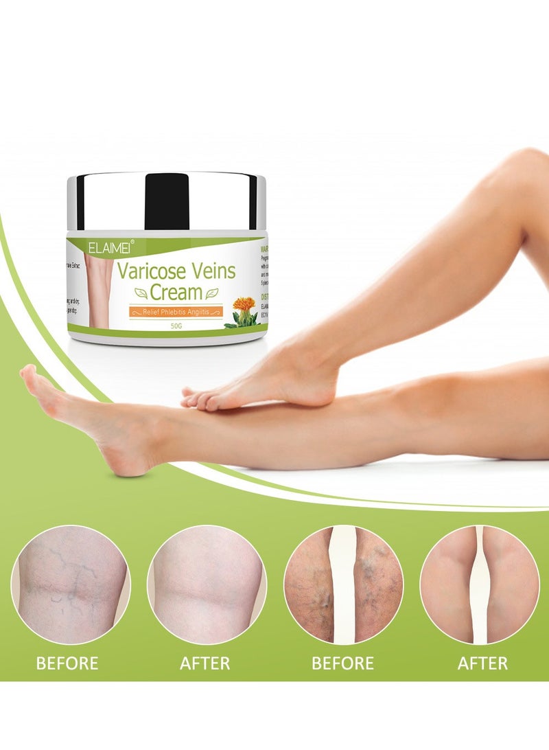 Elaimei Varicose Veins Cream for Relieve Leg Meridian Pain and Swelling,Care for Legs  - Image 3