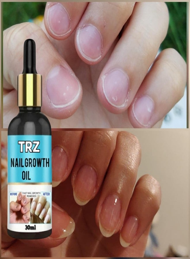 TRZ Nail Repair Strong Nail Shiny & Stronger Serum for Nail Growth & Repair, Fungal Infection, Anti-infective Removal nail strengthening oil strong 30ml - Image 2