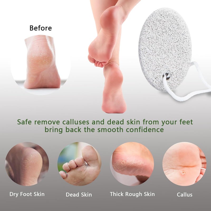 Borogo Natural Pumice Stone for Feet, Borogo 3-Pack Lava Pedicure Tools Hard Skin Callus Remover for Feet and Hands - Natural Foot File Exfoliation to Remove Dead Skin, Heels, Elbows, Hands - Image 4