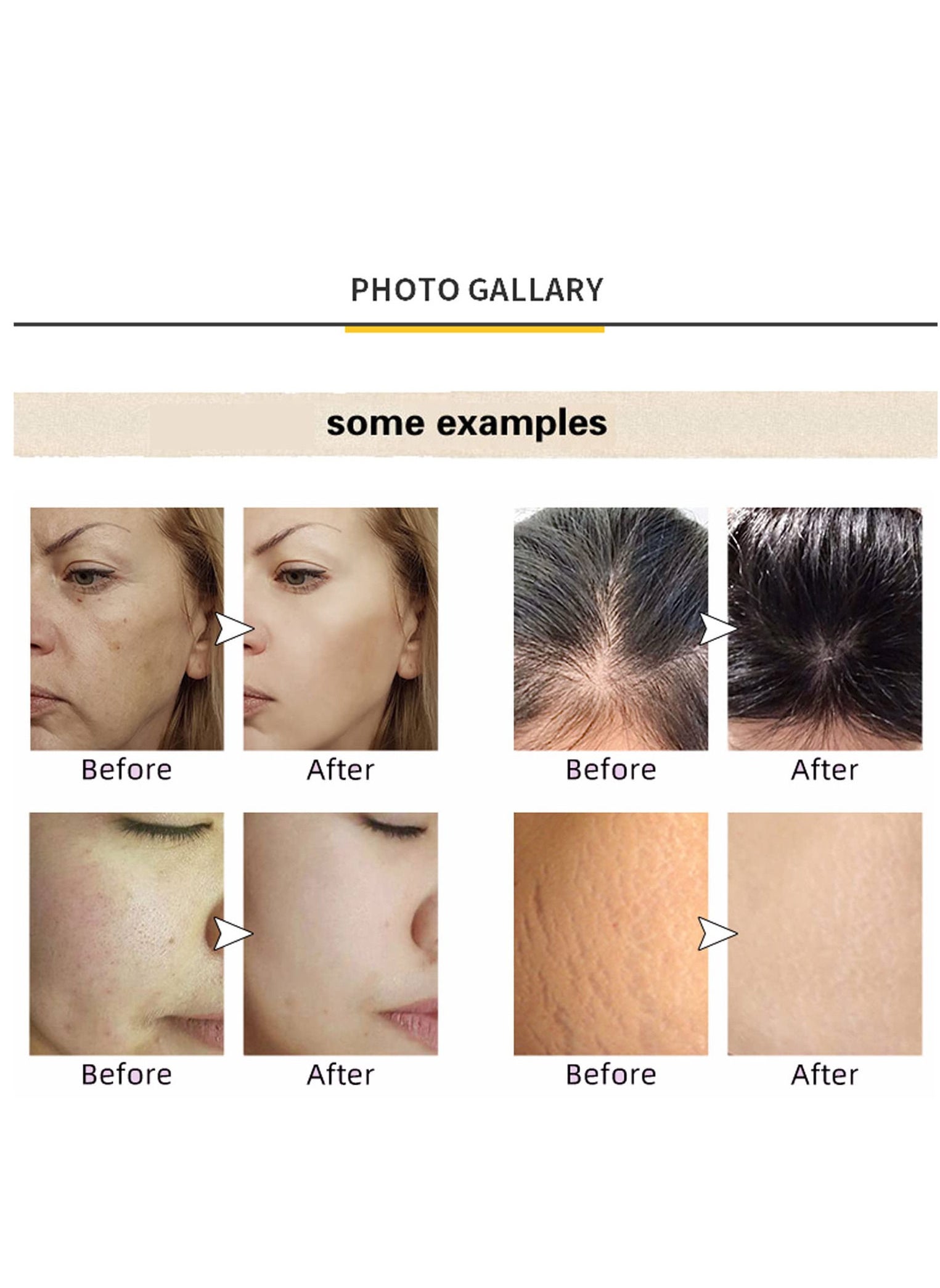 Adjustable Microneedling Derma Stemp Pen,Alternative140 Titanium 0.25 Mm Pins For Face Body Skin Care And Hair Beard Growth - https://f.nooncdn.com/p/pzsku/Z294A432A153CE215CC7DZ/45/_/1666865784/afab90c0-41d0-40ba-8b80-e5068b5eb9f6.jpg?width=original