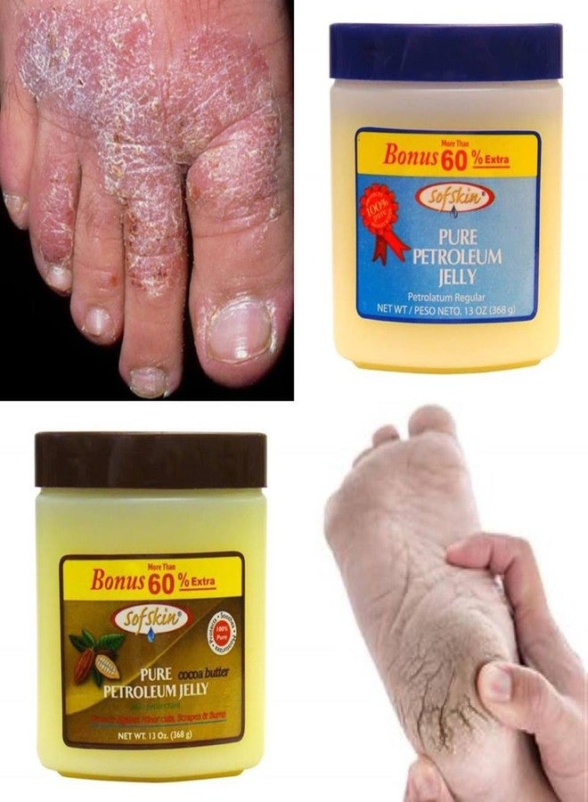 SOFSKIN (USA) Brand)100% PURE PETROLEUM JELLY (Amber Yellow) 226 gm - No smell, No artificial colour - Image 3