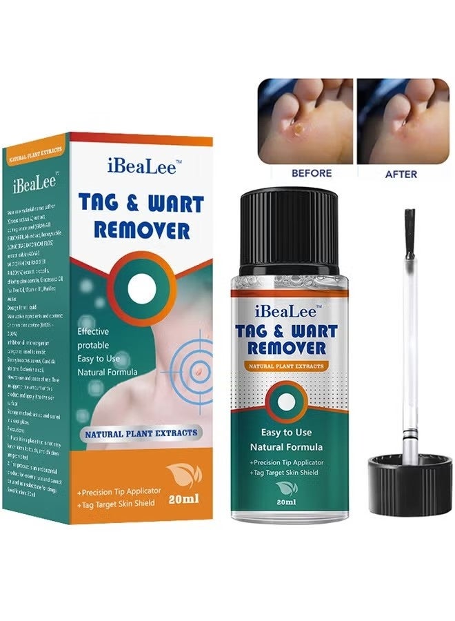  iBealee Natural & Safe Wart And Mole Remover Liquid, Wart Remover Liquid, Salicylic Acid Fast-Acting Formula For Plantar Warts, Skin Tags, Corns & Callus Removal, Pain-Free Scar-Free Treatment, Toes & Foot Care For Men & Women, 20ml - Image 1