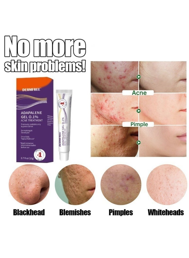 DERMFREE Adapalene Gel Acne Treatment Acne Treatment Cream Acne Treatment Ointment Gel Acne Relief Cream Gentle Moisturizing Acne Removing Gel Pimple and Acne Removal Anti Acne Gel 20g - Image 3