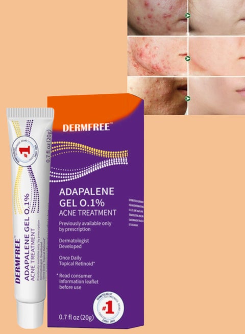 Adapalene Gel Acne Treatment Acne Treatment Cream Acne Treatment Ointment Gel Acne Relief Cream Gentle Moisturizing Acne Removing Gel Pimple and Acne Removal Anti Acne Gel 20g
