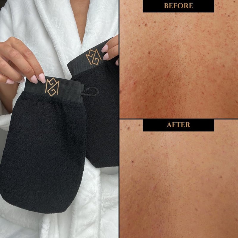 MS Exfoliating Glove Kessa Mitt Body Scrubber - Dead Skin Remover Shower Glove for Dead Skin Scrubbing and Deep Pore Cleansing - by MoroccanSource (3 piece spa set) - Image 4