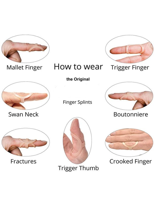 Generic 3 Piece Finger Fixation Splint Set, Offer Lightweight Support With a Sleek, Low-Profile Design, Comfortable Enough To Wear, Offer Superior Double-Sided Support and an Adjustable Fit  - Image 2
