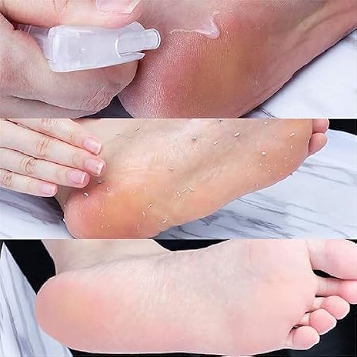Smile with Silk Feet! get rid of dry, cracked feet with instant foot exfoliation spray.Effective Korean Exfoliator Removes Dead Skin and Gives You Softness Four Generic - Image 5