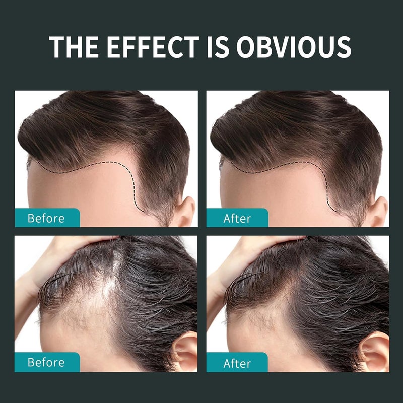 Sevich Hair Fiber Spray - Instant Hair Thickening Powder for Men & Women, Hair Building Fibers for Thinning Hair, Root Touch Up Hair Color, Waterproof, Sweatproof, Natural Look,120ml Dark Brown - Image 4