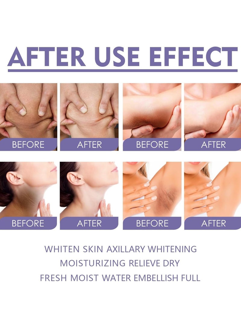 Eelhoe Body Whitening Balm Underarm Knee Neck Moisturizing Light Melanin Brightening Body Care Cream Remove Melanin Improve Dull Brighten Skin Care(40g) - Image 4