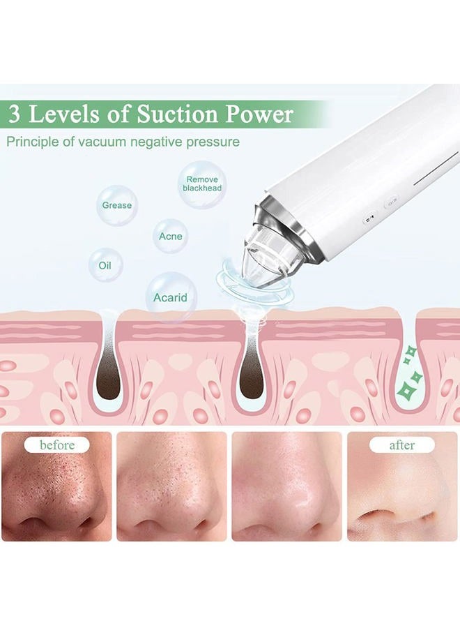 prabensei Blackhead Remover Pore Vacuum, 【[FDA Certification] 】 WiFi Visible Facial Pore Cleanser with HD Camera Pimple Acne Comedone Extractor Kit with 6 Suction Heads Electric Blackhead Suction Tool - Image 5