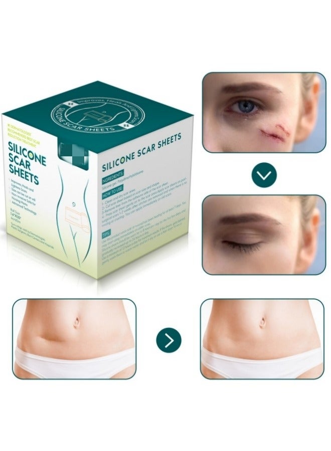 general Silicone Scar Sheets (1.6” x 120” Roll-3M), Silicone Scar Tape Roll, Scar Silicone Strips, Reusable, Professional Scar Removal Sheets for C-Section, Surgery, Burn, Keloid, Acne et - Image 2