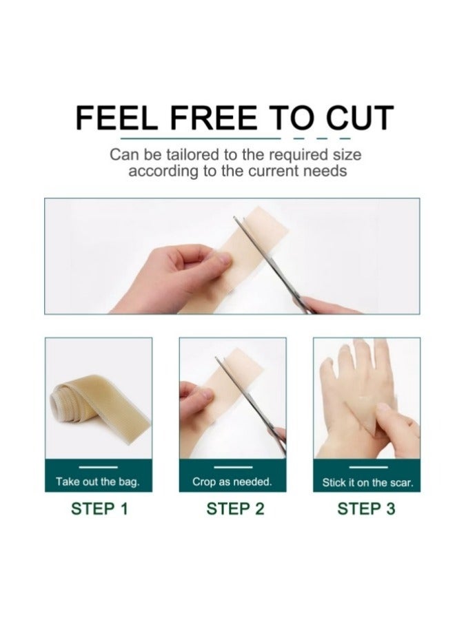 general Silicone Scar Sheets (1.6” x 120” Roll-3M), Silicone Scar Tape Roll, Scar Silicone Strips, Reusable, Professional Scar Removal Sheets for C-Section, Surgery, Burn, Keloid, Acne et - Image 3