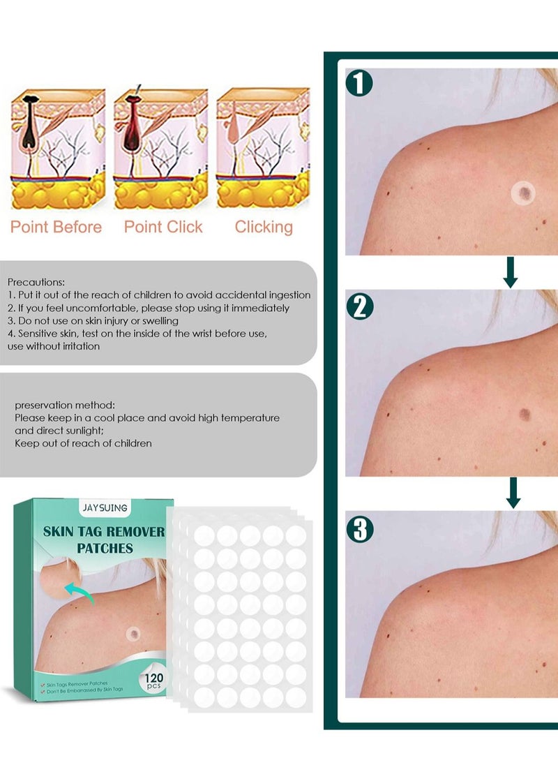 Jaysuing - Skin Tag Remover Patches, Painless Effective Fast Transparent and Ultra-Thin Mole Warts Removal Sticker for Face and Body 120 Pcs - Image 1