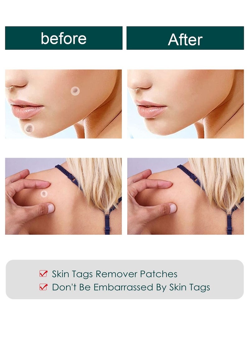 Jaysuing - Skin Tag Remover Patches, Painless Effective Fast Transparent and Ultra-Thin Mole Warts Removal Sticker for Face and Body 120 Pcs - Image 1