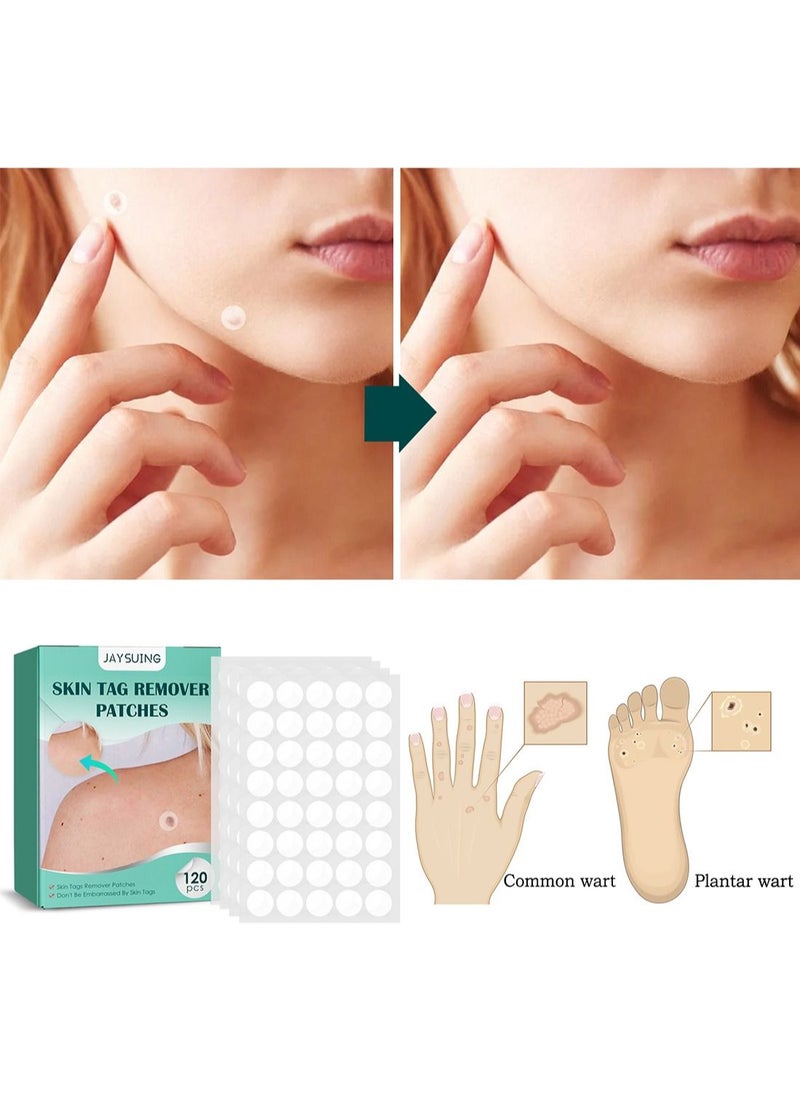 Jaysuing - Skin Tag Remover Patches, Painless Effective Fast Transparent and Ultra-Thin Mole Warts Removal Sticker for Face and Body 120 Pcs - Image 1