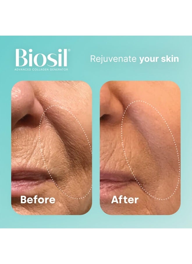 BIOSIL - Drops - 1 fl oz - with Patented ch-OSA Complex - Increase Collagen Production for Beautiful Hair, Skin & Nails - GMO Free - 120 Servings, 0.14 pounds - Image 1