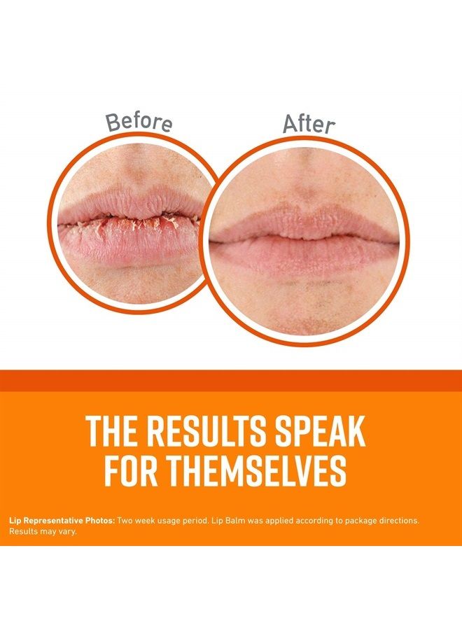 O'Keeffe's Unscented Lip Repair Lip Balm for Dry, Cracked Lips, Stick, (Pack of 3)  - Image 2
