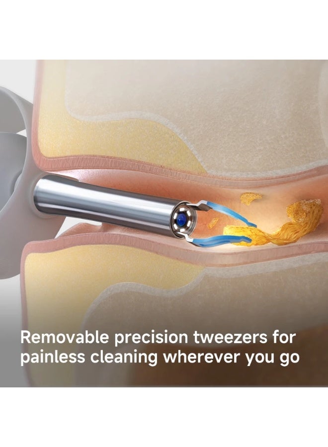 Bebird EarSight Plus Earpicks Ear Wax Removal Cleaner with tweezer 6 LED Lights 1080P FHD Video Otoscope - Image 4