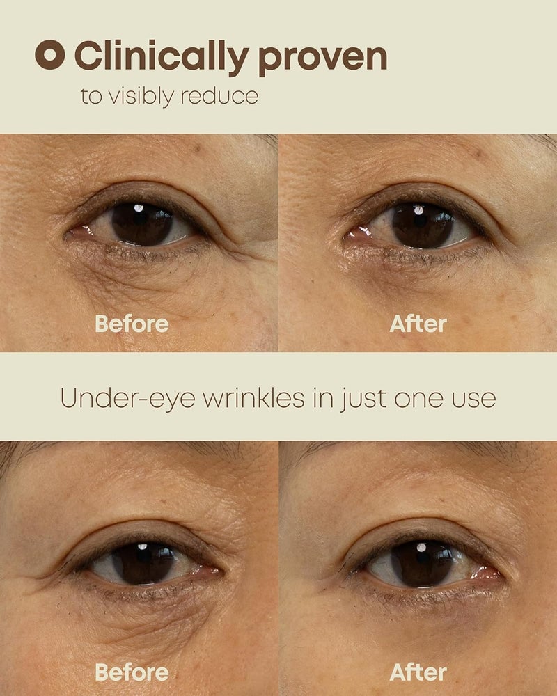 NINELESS EverYouth Dual Effect Eye Cream Korean Skincare Instant Lifting Technology for Firm Eyes with Niacinamide Adenosine Hyaluronic Acid Ceramides for Fine Lines Bags Puffiness 05 fl oz - Image 4