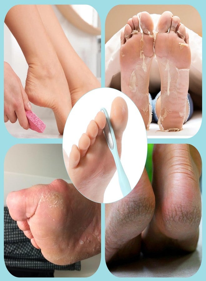 Tyqour Toe Callus Remover Foot Scraper for Callus Removal Mini Foot Files Foot Scrubber Dead Skin Remover Foot Exfoliator Tool with Compact Design for Pedicures and Sensitive Areas - Image 4