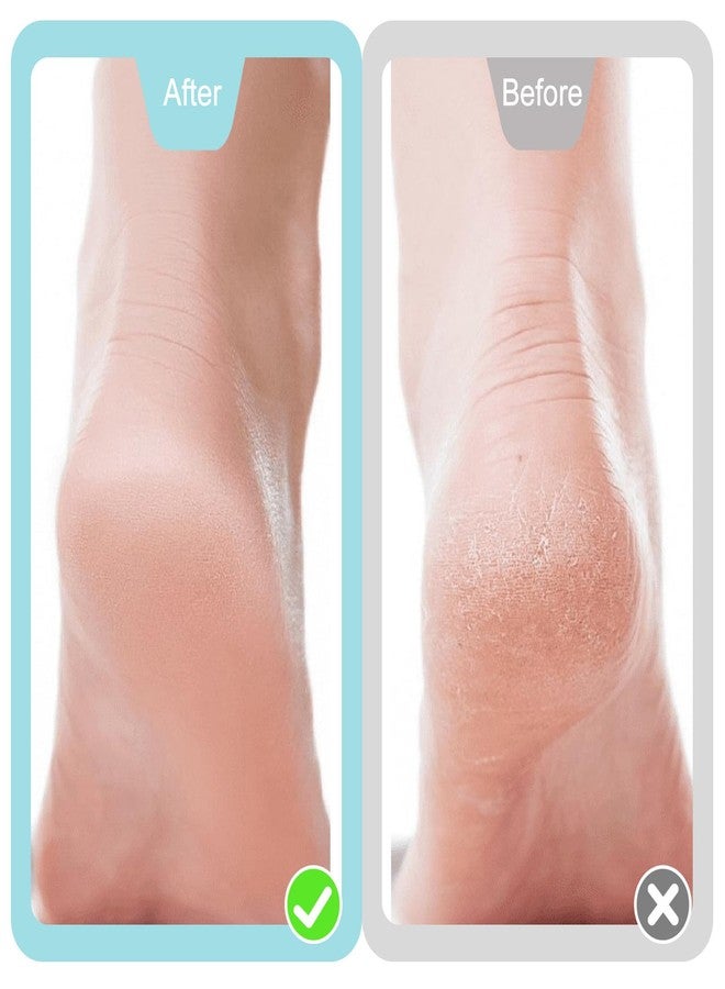 Tyqour Toe Callus Remover Foot Scraper for Callus Removal Mini Foot Files Foot Scrubber Dead Skin Remover Foot Exfoliator Tool with Compact Design for Pedicures and Sensitive Areas - Image 5