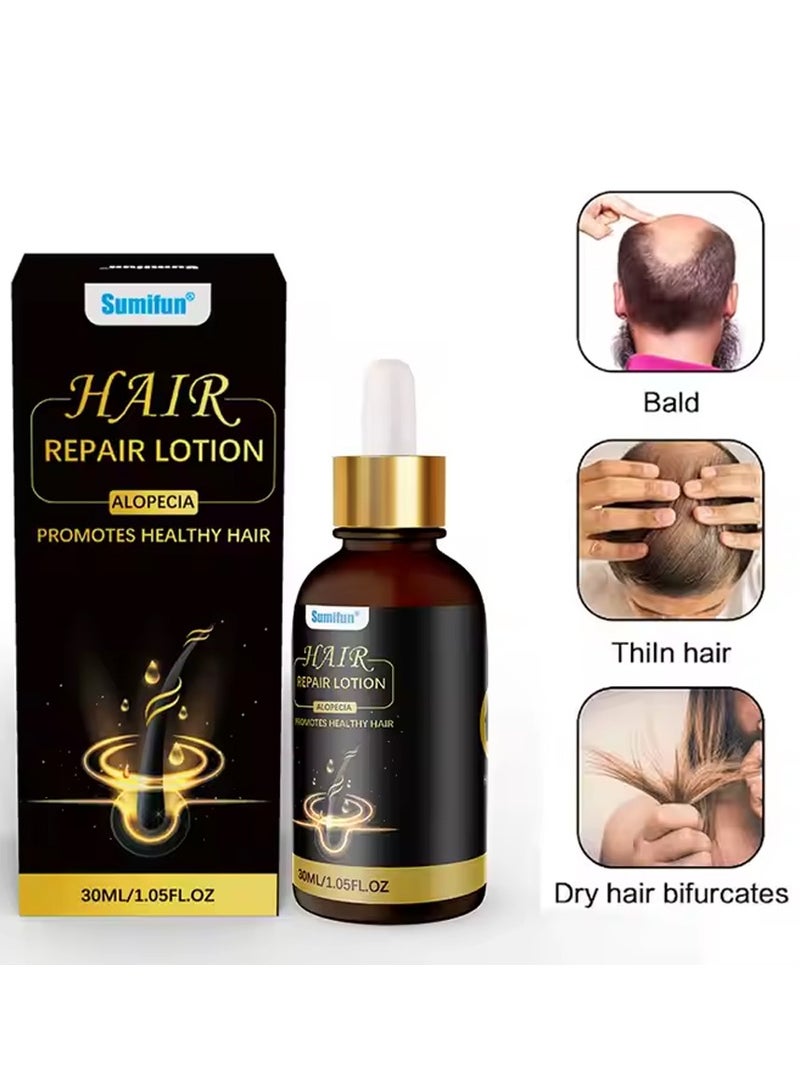 Sumifun Hair Repair Lotion Alopecia Promotes Healthy Hair，Suitable for both men and women 30ml - Image 1