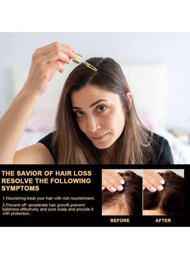 Sumifun Hair Repair Lotion Alopecia Promotes Healthy Hair，Suitable for both men and women 30ml - Image 4