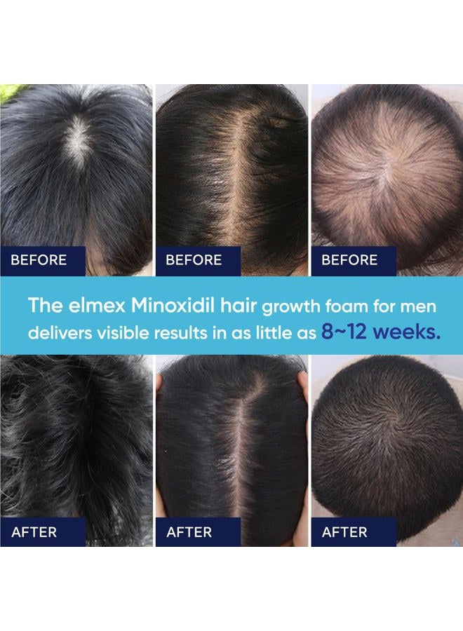 Artimore 5% Minoxidil Foam for Men and Women, 5% Minoxidil for Men Foam, Minoxidil for Women Hair Growth (60) - Image 5