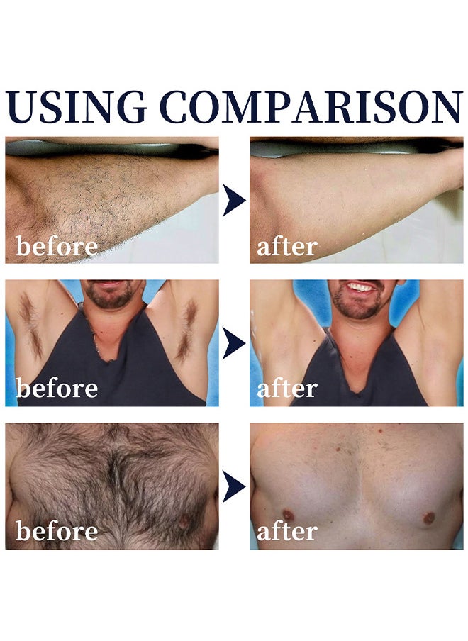East Moon - Hair Removal Spray Foam For Men, No Irritation Hair Removal Cream, Safe Hair Depilatory For Male Underarm, Chest, Back, Legs, Natural Ingredient Hair Removal Spray Foam  For Men 100ML - Image 1