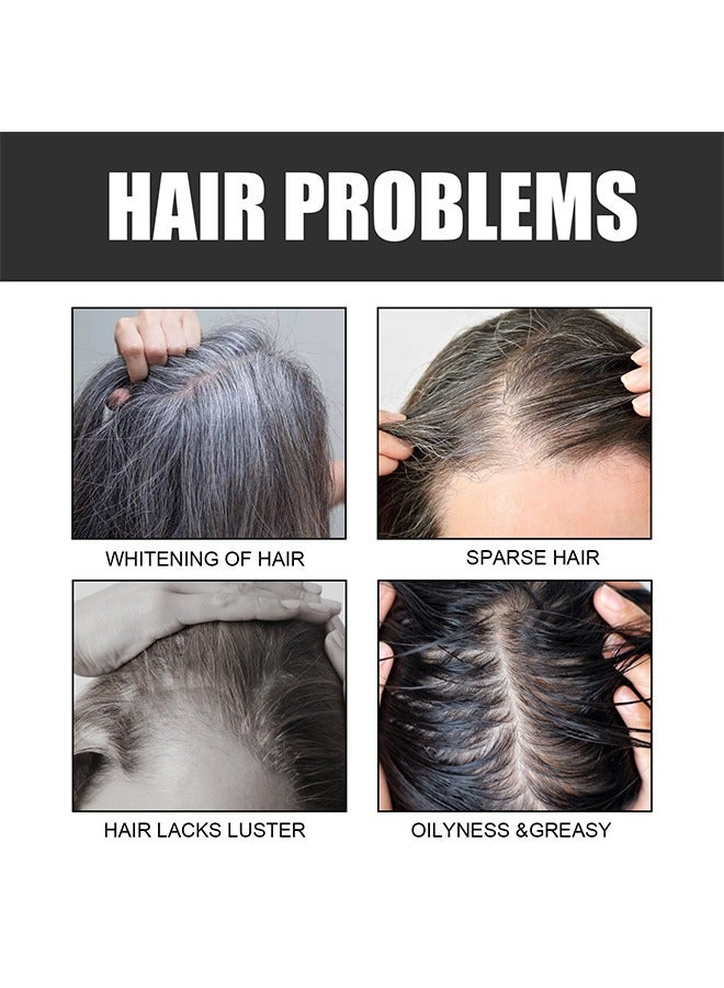 OUHOE Black Hair Soap Gray Hair Reverse Bar for Stronger, Smoother, and Shinier Hair - Image 2