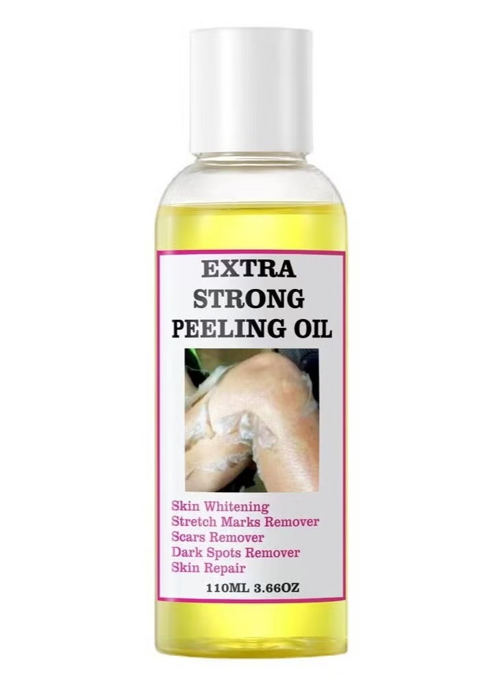 EELHOE Extra Strong Peeling Oil 110ml Super Strength Dead Skin Remover Skin Moisturizing Hydrating Butter Peeling Remove Dead Skin and Calluses on Feet and Hand Dark Spot Peeling Oil ﻿ - Image 1