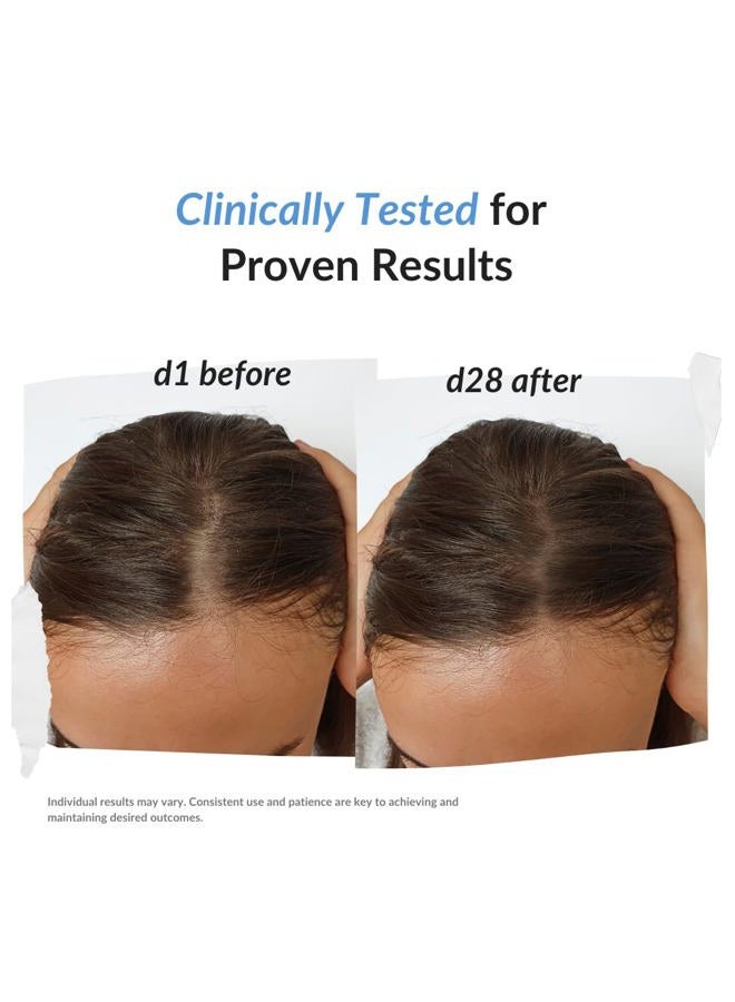 rekze 24 Serum for Hair Regrowth – Clinically Proven 5% Procapil Formula, Advanced Thickening Treatment for Men & Women, DHT Blocker Spray Prevents Thinning, Hair Loss & Targets Baldness - Image 5