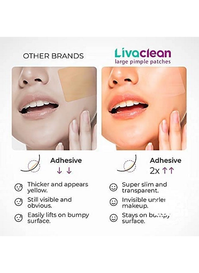 LivaClean - 20 Ct Livaclean Large Hydrocolloid Acne Patches For Pore Spots Nose Face Cystic Pimple Zit Patch Big Pimple Patches Hydrocolloid Bandages Strips Stickers Pimple Patch Xl Large Acne Patch - Image 1