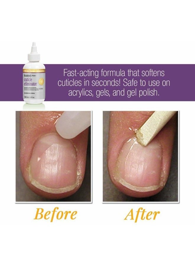 ProLinc Cuticle Eliminator, Softens and Removes Cuticles in Seconds, 4 oz - Image 3