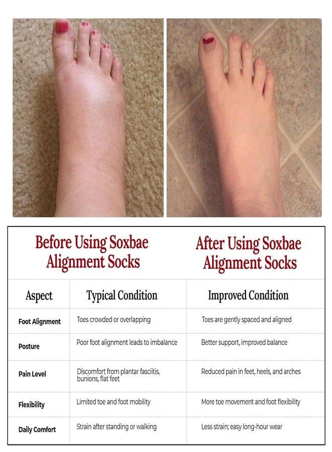 ZOQWEID Foot Alignment Socks Men & Women | Five Toe Separator | Foot Pain Relief | Bunion Corrector | Plantar Fasciitis | Improving Posture & Increasing Flexibility | Free Size | Black | 1 Pair - Image 3