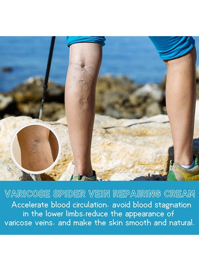 West&Month Varicose Spider Vein Repairing Cream - for Legs Reduces Spider Veins and Heaviness Anti Varicose Vein Soothing Leg Cream to Improve Blood Circulation Enhance Capillary Varicose Vein Repair Cream 30g - Image 3