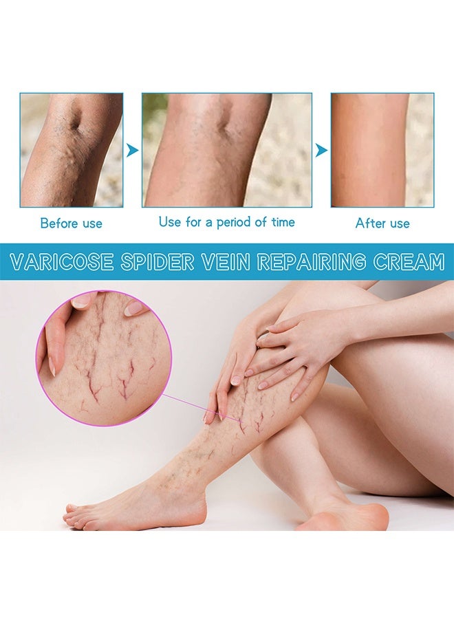 West&Month Varicose Spider Vein Repairing Cream - for Legs Reduces Spider Veins and Heaviness Anti Varicose Vein Soothing Leg Cream to Improve Blood Circulation Enhance Capillary Varicose Vein Repair Cream 30g - Image 5