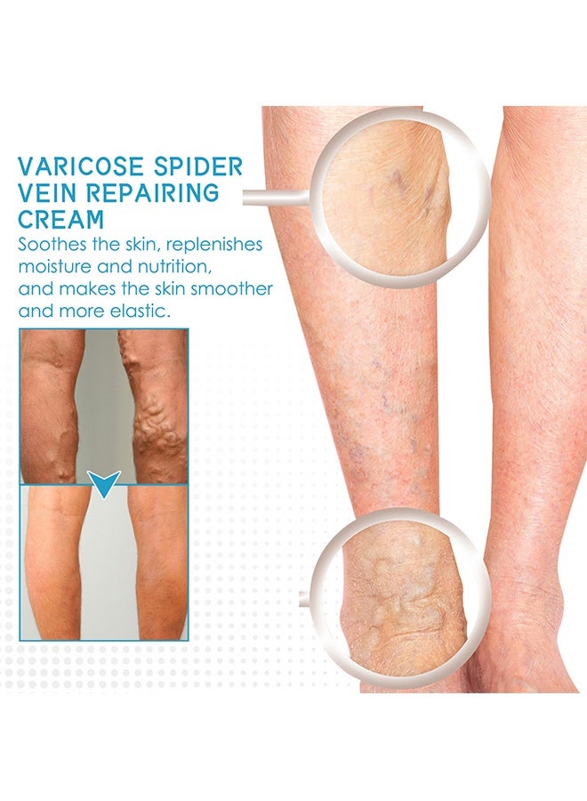 West&Month Varicose Spider Vein Repairing Cream - for Legs Reduces Spider Veins and Heaviness Anti Varicose Vein Soothing Leg Cream to Improve Blood Circulation Enhance Capillary Varicose Vein Repair Cream 30g - Image 4