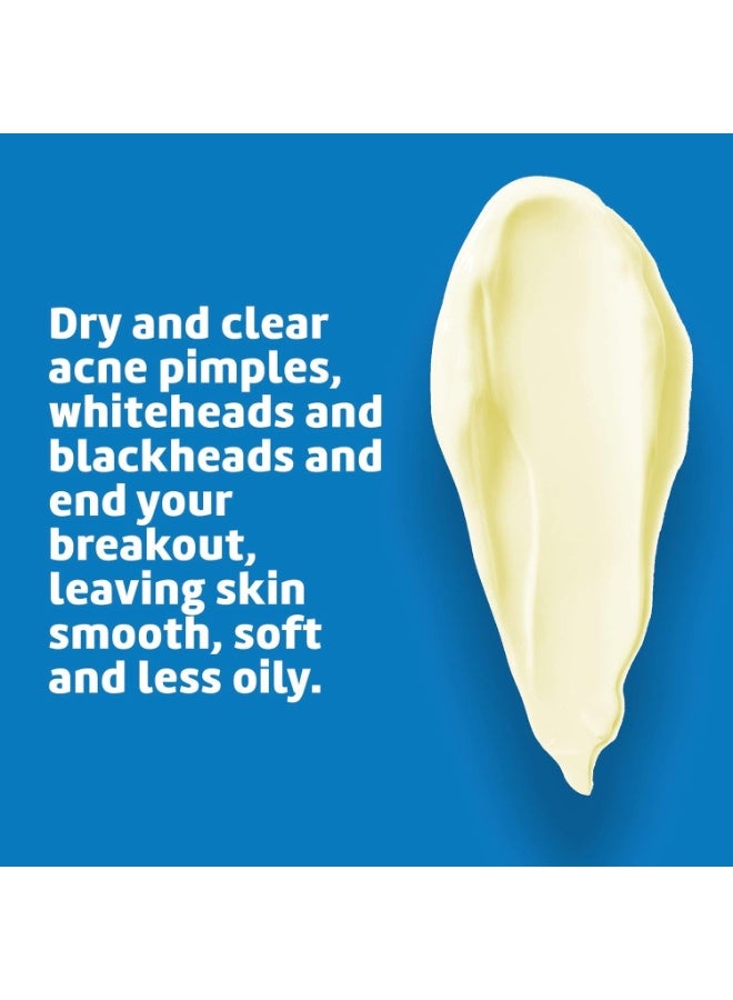 دي لا كروز مرهم لعلاج حب الشباب 74 جرام - Image 2