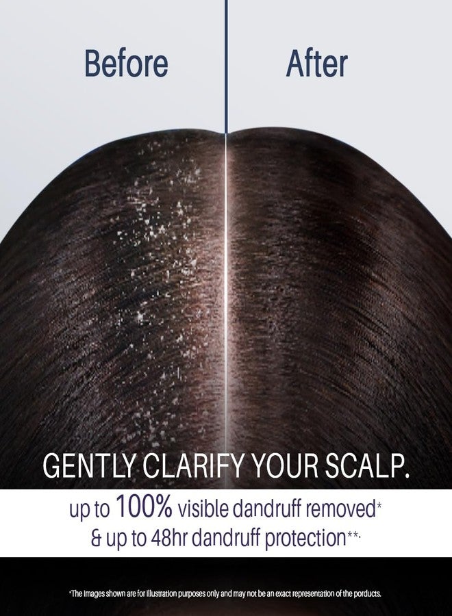 Sanfe Intant Dandruff Removal Gel, Anti Dandruff | Soothes Itchy Scalp | Reduces Flakes & Irritation | Non-Sticky, Wash-Off Formula | Promotes Healthy Hair Growth | With Menthol and Lemon, 100g - Image 2