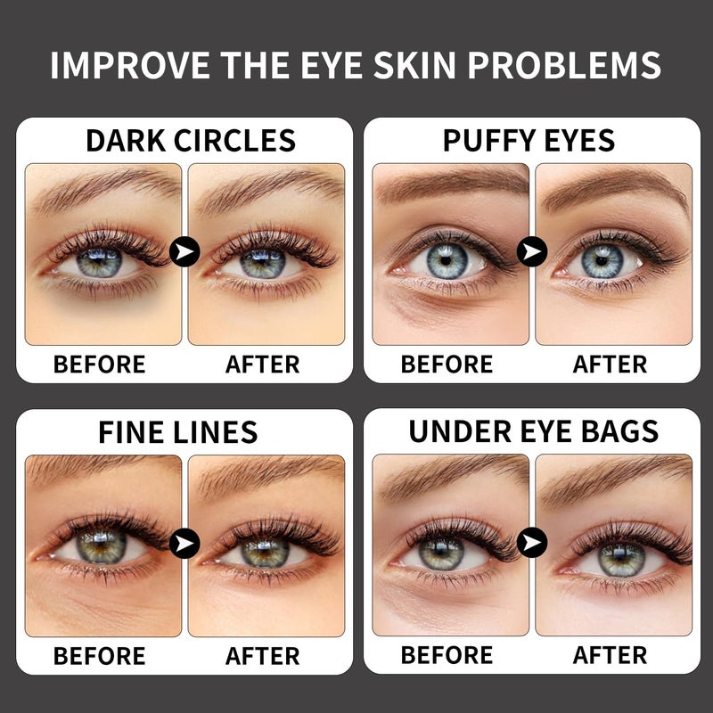 ROUSE Collagen Under Eye Patches with Caffeine Eye Treatment Mask for Dark Circles Eye Fatigue Puffiness Refreshing Revitalizing Skin Care Eye Gel Pads-20 Pairs - Image 4