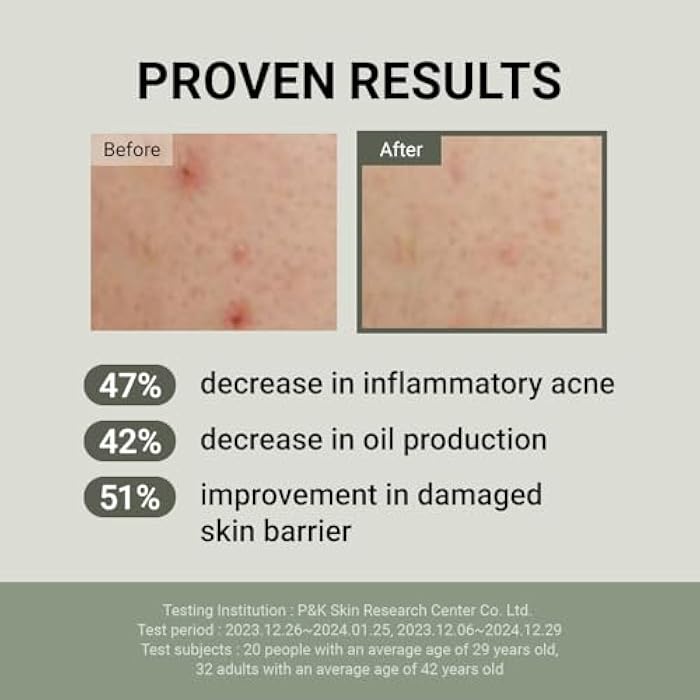 JUMISO Snail Mucin 88 Peptide Cream - Korean Face Moisturizer 5-Peptide Complex Collagen Boost Hyaluronic Acid Niacinamide Damaged Skin Repair - Sensitive Skin Non-Comedogenic 3.38 oz. - Image 3