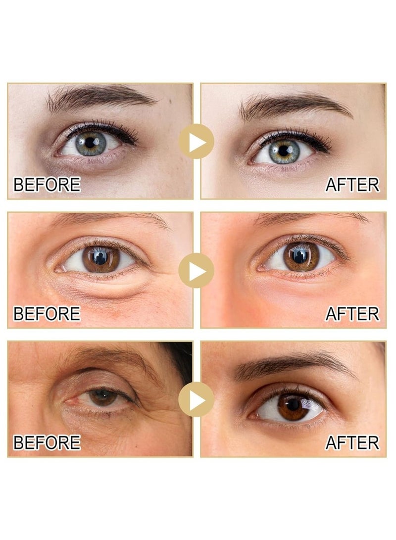 Hoygi Collagen Eye Cream Eye Bags Treatment for Women Firming Eye Treatment Anti Aging Eye Cream for Puffiness and Bags Under Eyes Under Eye cream for Dark Circles Moisturizing Eye Serum  - Image 4