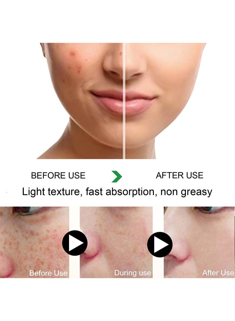 إيلهو كريم تبييض البقع، كريم إزالة التصبغات للوجه، كريم مزيل النمش، كريم مرطب مضاد للعيوب، كريم تبييض البشرة لإزالة البقع الداكنة (كريم النمش) - Image 3