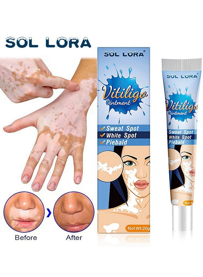 SOL LORA Vitiligo Ointment, Vitiligo Treatment For Skin Vitiligo, Vitiligo Care Cream For Reduce White Spots And Improve Skin Pigmentation 20G - Image 1