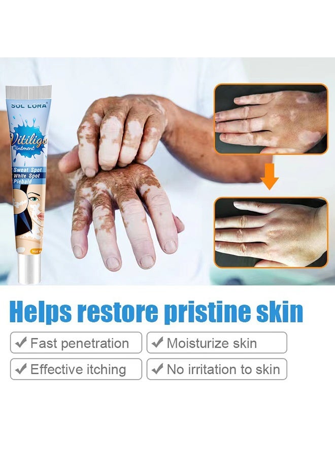 SOL LORA Vitiligo Ointment, Vitiligo Treatment For Skin Vitiligo, Vitiligo Care Cream For Reduce White Spots And Improve Skin Pigmentation 20G - Image 4