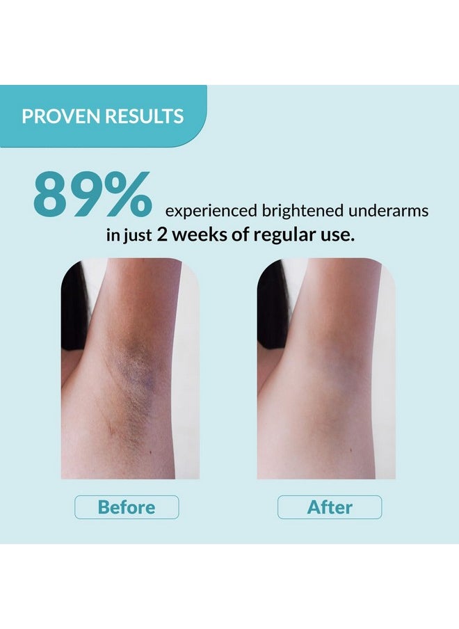 FIXDERMA FIXDERMA Nigrifix Underarm Roll On With 6% Aha, Lactic Acid & 1% Mandelic Acid & Kojic Acid | Brightens Skin & Exfoliates Underarm | For All Skin Type, Men & Women - 60Ml  - Image 5